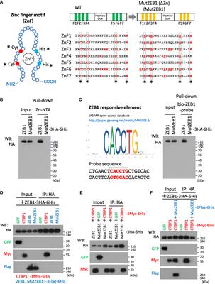 LOXL1 and LOXL4 are novel target genes of the Zn2+-bound form of ZEB1 and play a crucial role in the acceleration of invasive events in triple-negative breast cancer cells